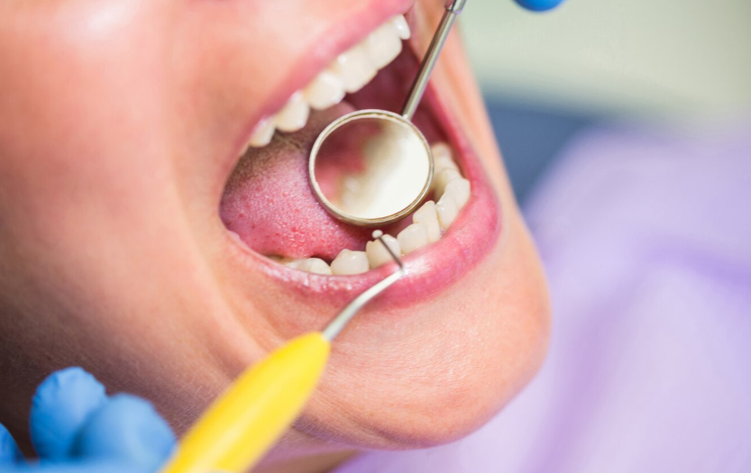 Küretaj (derin temizlik)